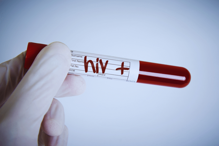 HIV é isento imposto de renda